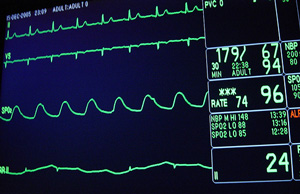 Heart Monitor