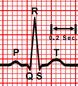 P-QRS-T